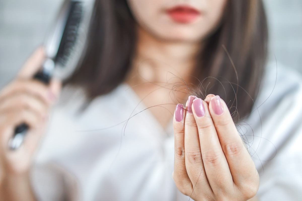 Woman with hair loss