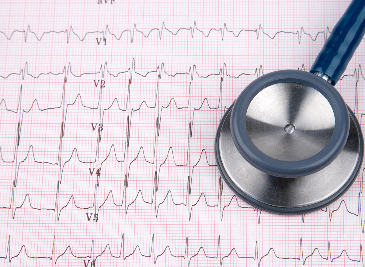 ekg ecg heart test with stethoscope