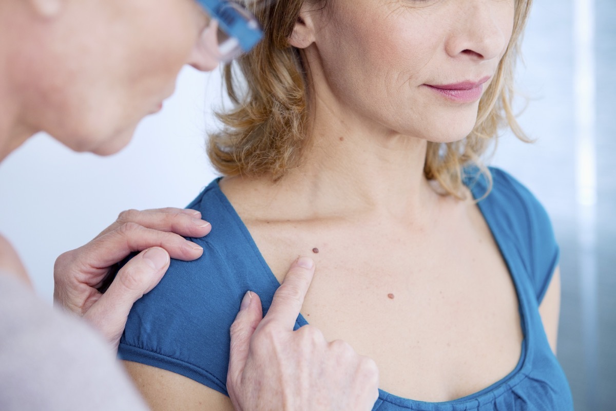 Dermatology exam with Woman patient