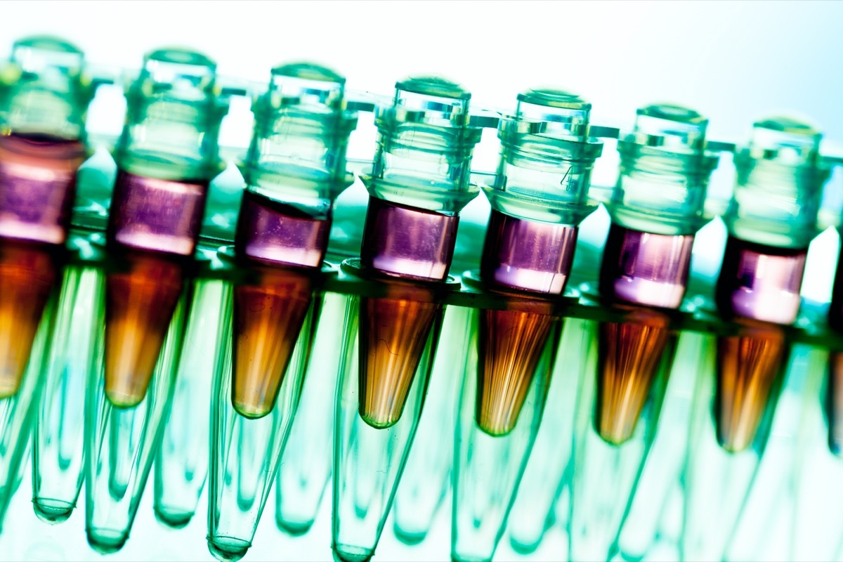 Laboratory research of cancer diseases, rack with RNA samples