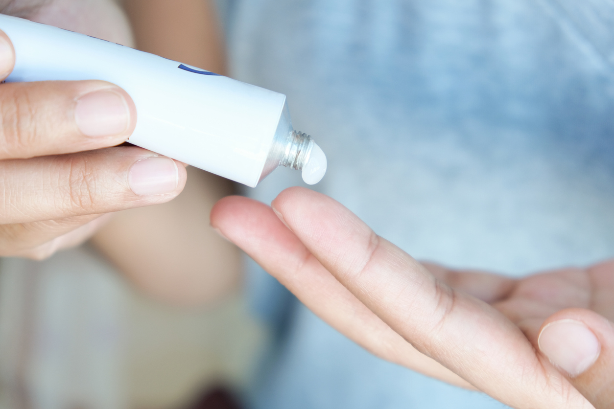 Woman's hands holding topical cream.