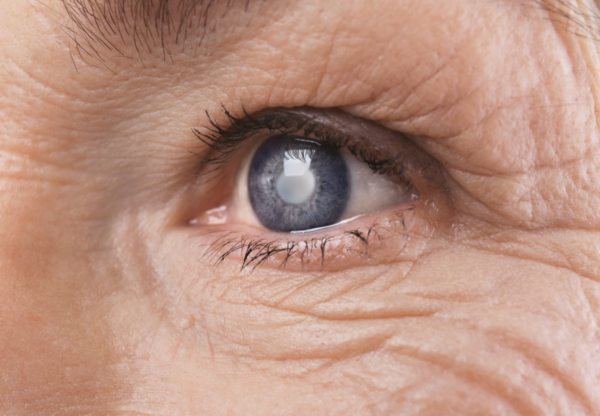  Senior woman's eye