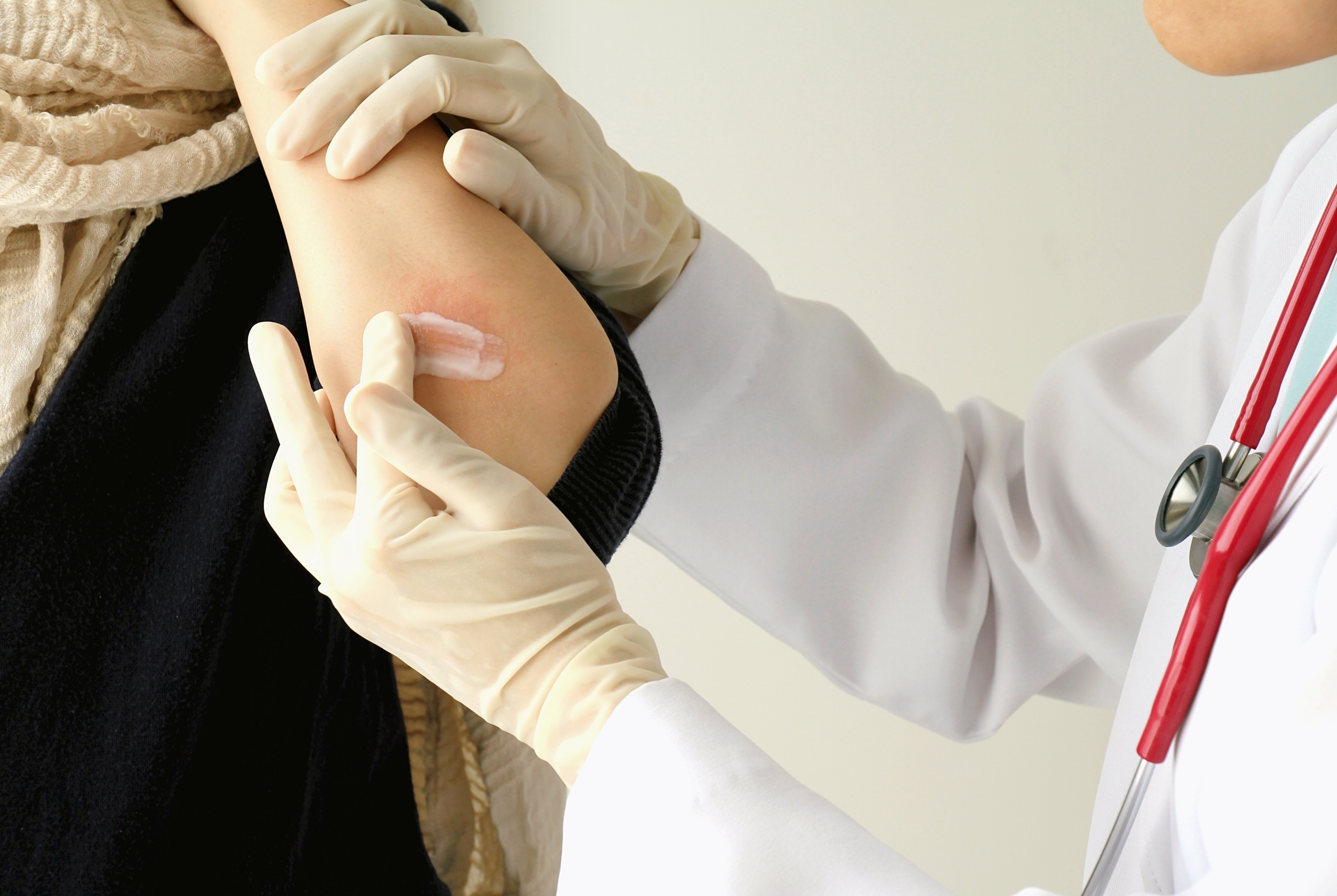 doctor applying cream to white woman's elbow