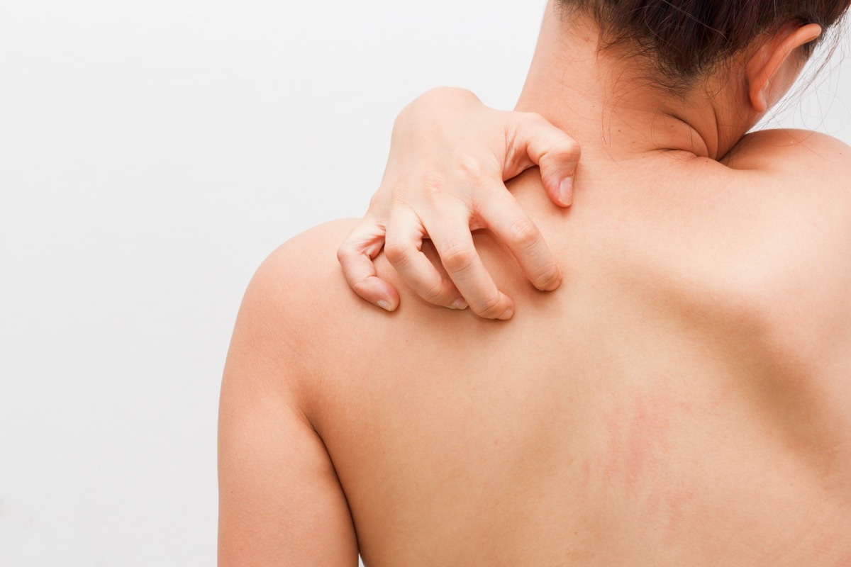 woman trying to scratch her back between shoulders, everyday words