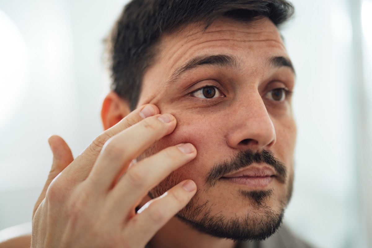 Close up shot of handsome man with beard using anti aging moisturizer in the morning. He is applying the cream under his eyes while looking at himself in the mirror.