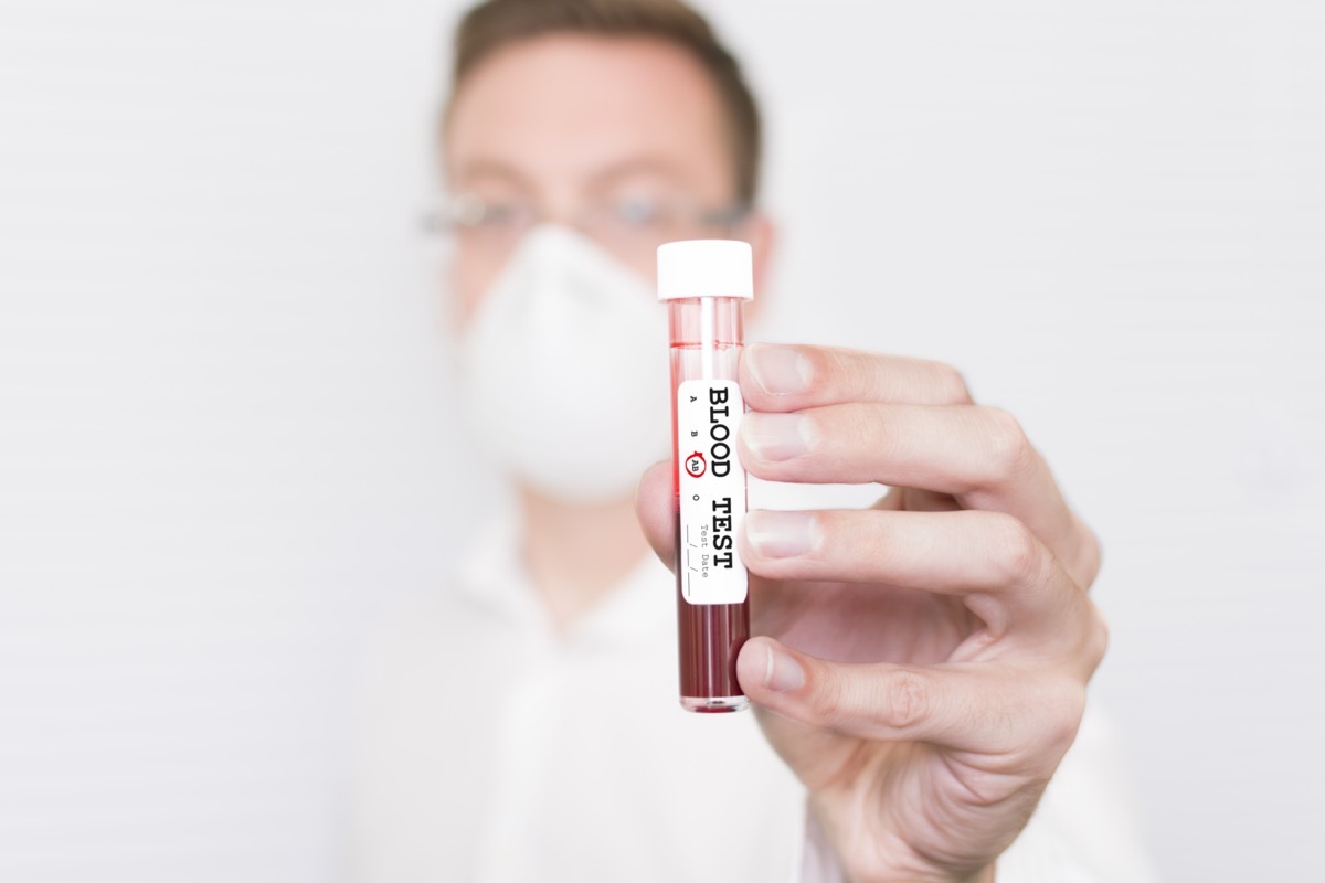 A male scientist/doctor holding a test tube marked Blood Test with group AB circled.