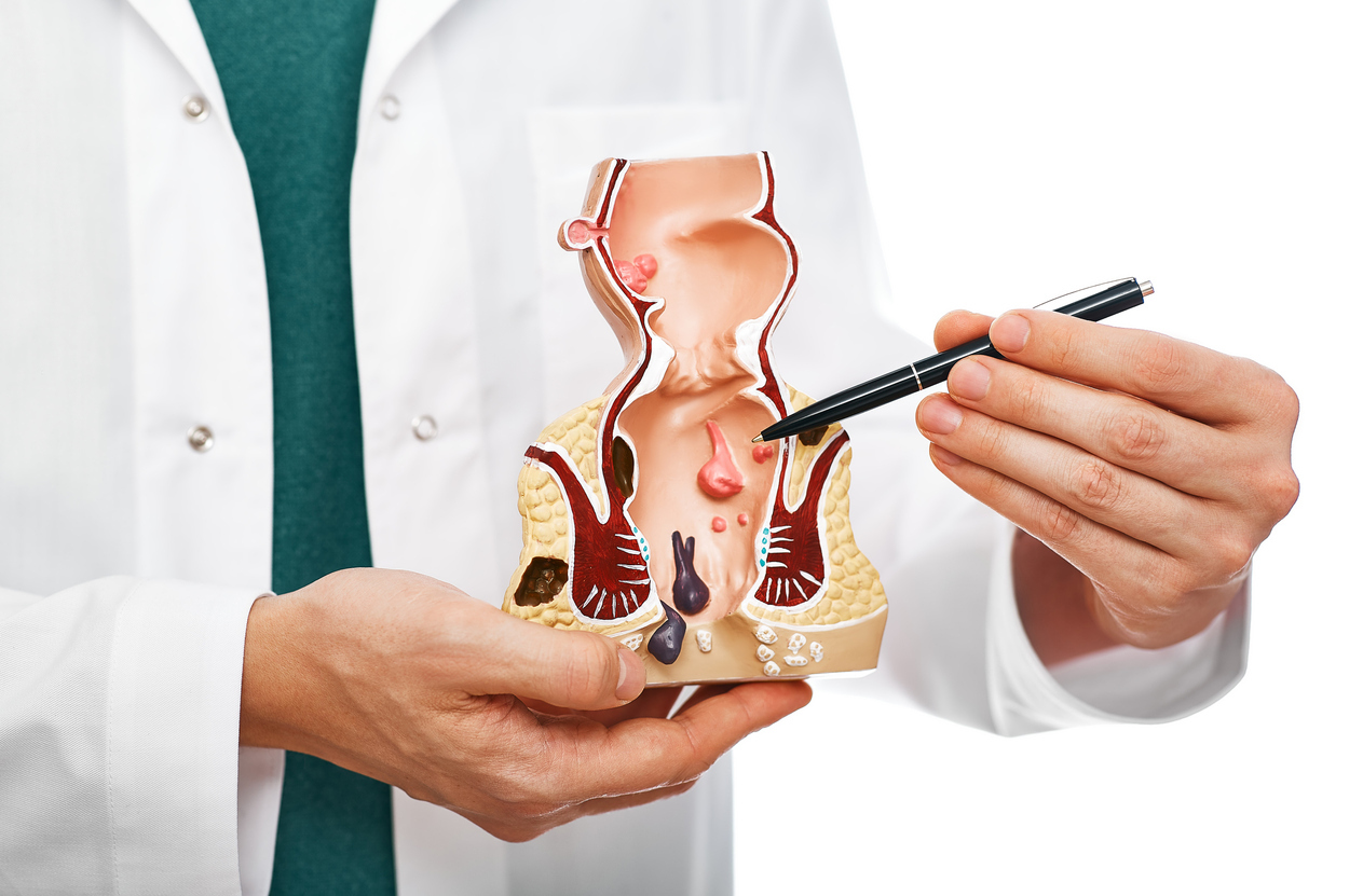 Proctologist pointing pen rectum pathologies on an anatomical model.